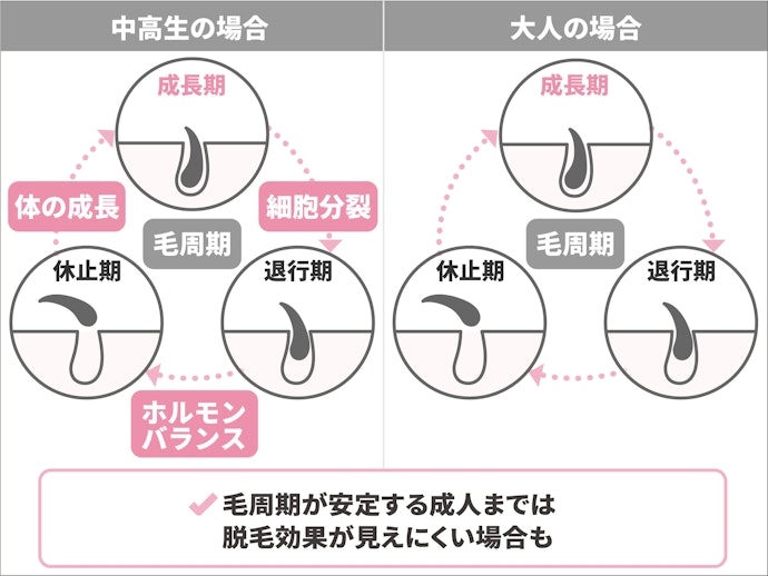 成長期の脱毛は効果が見えにくいことも。毛周期が安定するのは成人してから