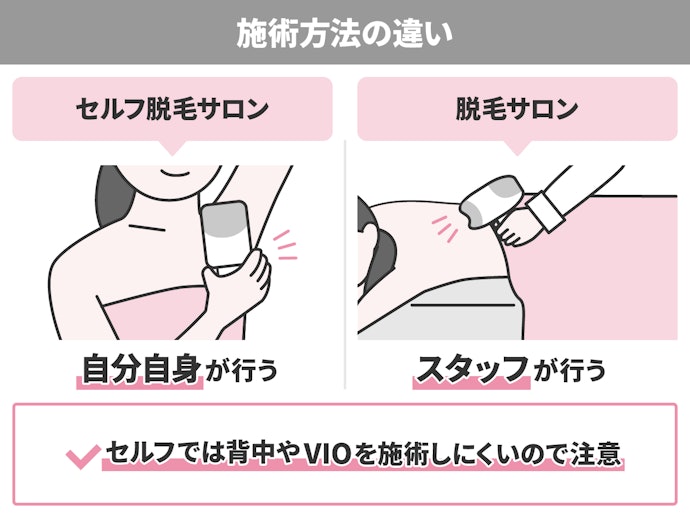 セルフ脱毛サロンは自分で照射する必要あり