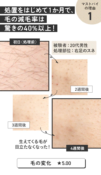 理由①:剛毛にも効果てきめん、毛が太く濃い人にこそ使ってほしい