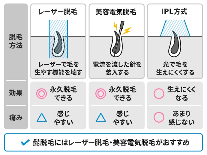 ヒゲ脱毛におすすめの施術方法は?レーザー脱毛?美容電気脱毛?