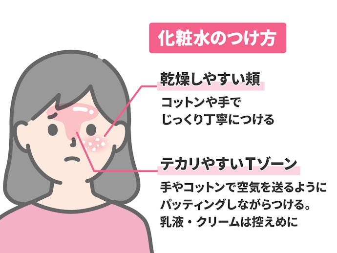 混合肌が化粧水をつけるときのポイントとは?