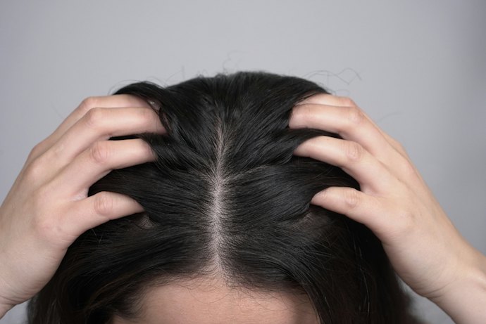 ヘッドスクラブは頭皮のニオイや抜け毛に効果はある?