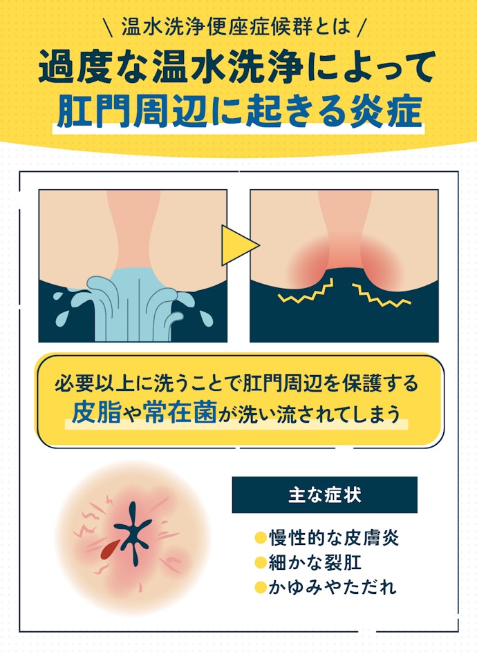 「温水洗浄便座症候群」とは?どんなリスクがある?