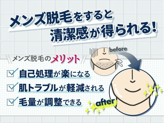 メンズ脱毛の好感度は高い!?メンズ脱毛のメリットとは?