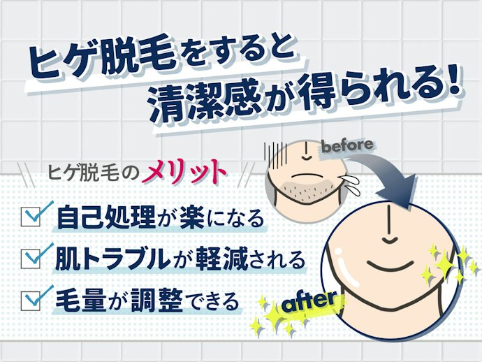 ヒゲ脱毛のメリットは?