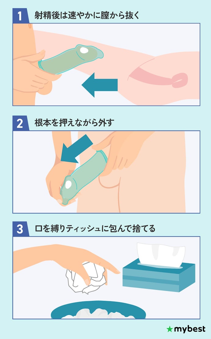 行為後はすぐに抜き取ろう!コンドームの正しい後処理方法は?