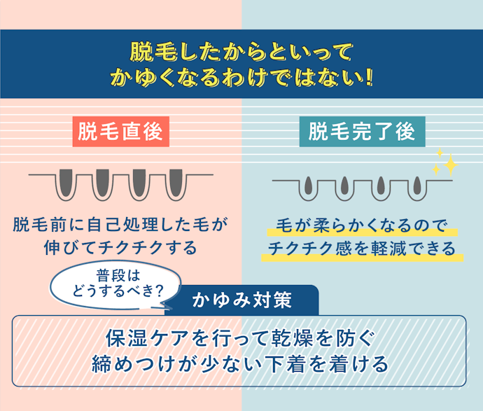 VIO脱毛するとかゆくなる?