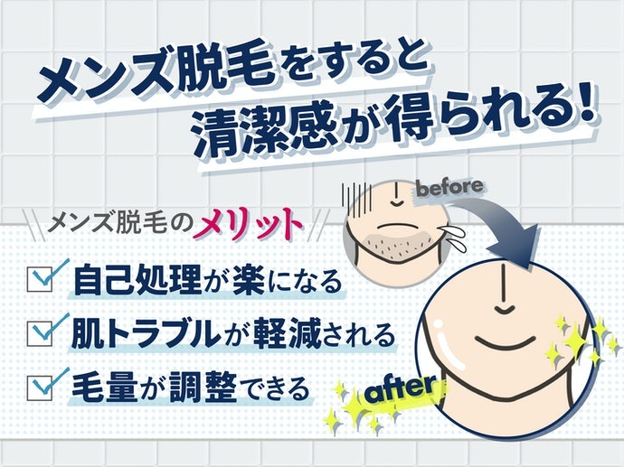 メンズ脱毛の好感度は高い!?メンズ脱毛のメリットとは?