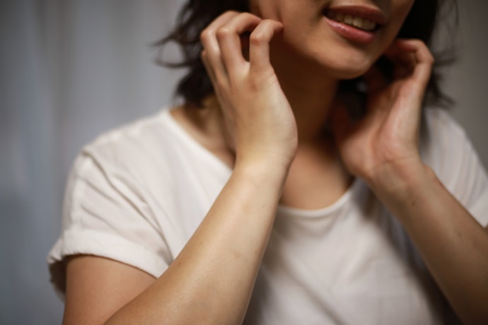 蕁麻疹の市販薬を服用したあとの注意点は?