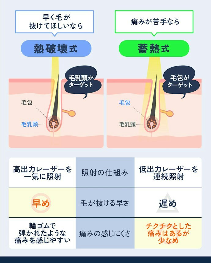 蓄熱式?熱破壊式?照射方式の違いとおすすめを解説