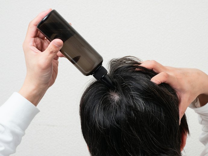 育毛剤や育毛シャンプーと併用してもよい?