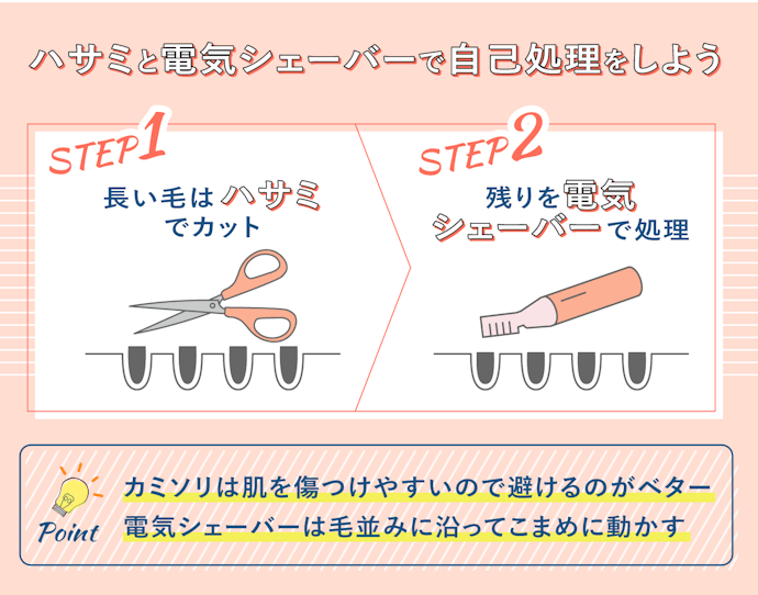VIOの自己処理の方法は?