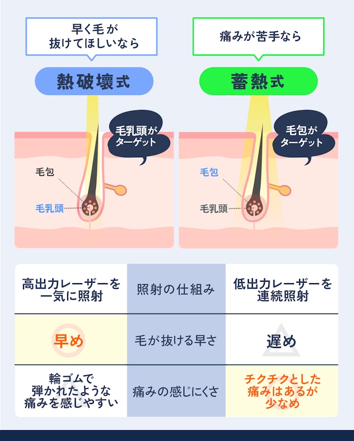 レーザーの蓄熱式と熱破壊式って何?どっちがいい?