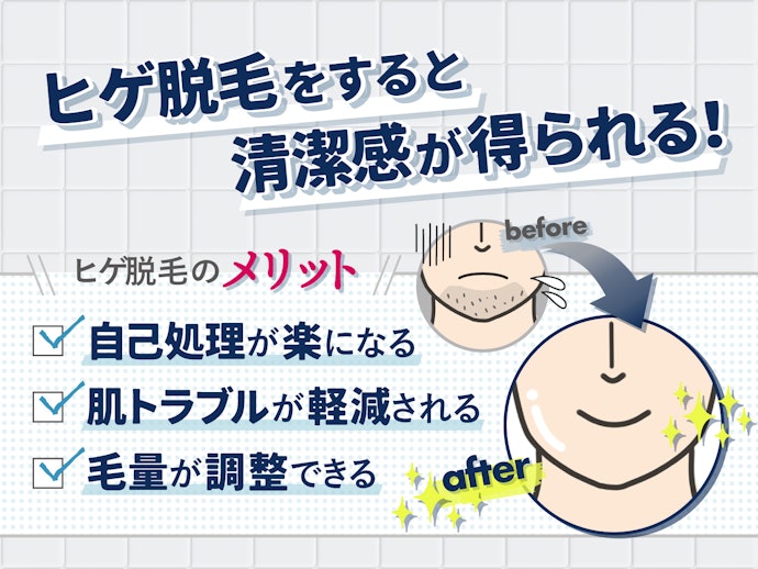 ヒゲ脱毛のメリットは?