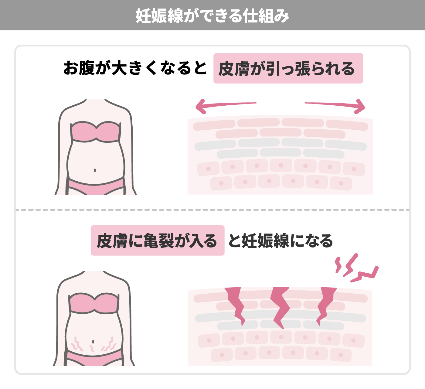 22年 妊娠線予防オイルのおすすめ人気ランキング19選 Mybest