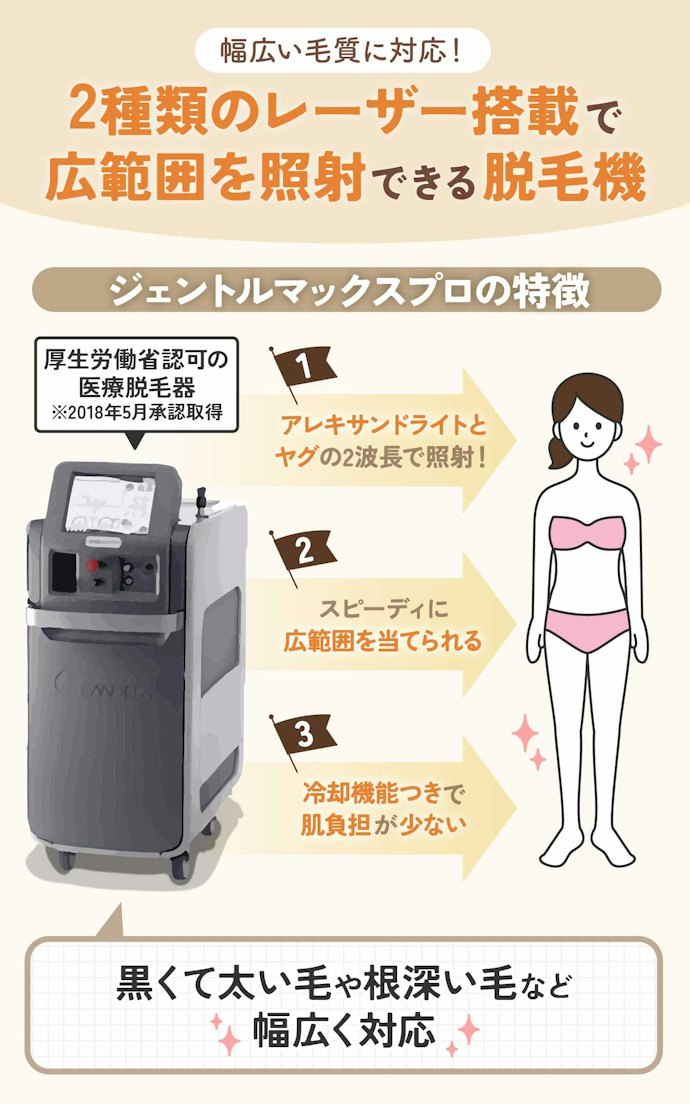 ジェントルマックスプロとは?どんな毛質に効果的?