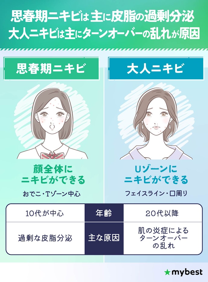 思春期ニキビと大人ニキビの違いと原因ってなに?