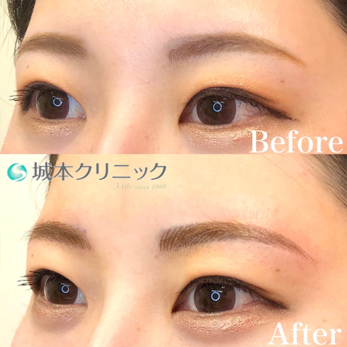 沖縄のアートメイクが受けられるおすすめクリニック【2025年】 | マイ