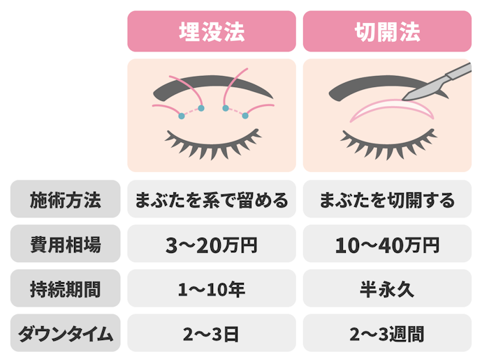 二重整形の埋没法と切開法の違いは?費用はどれくらい?