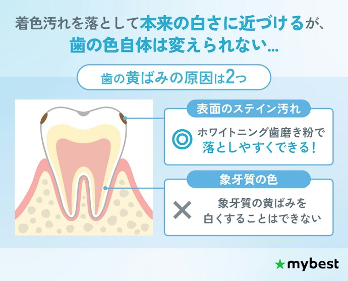 ホワイトニング歯磨き粉で歯は白くなるの?
