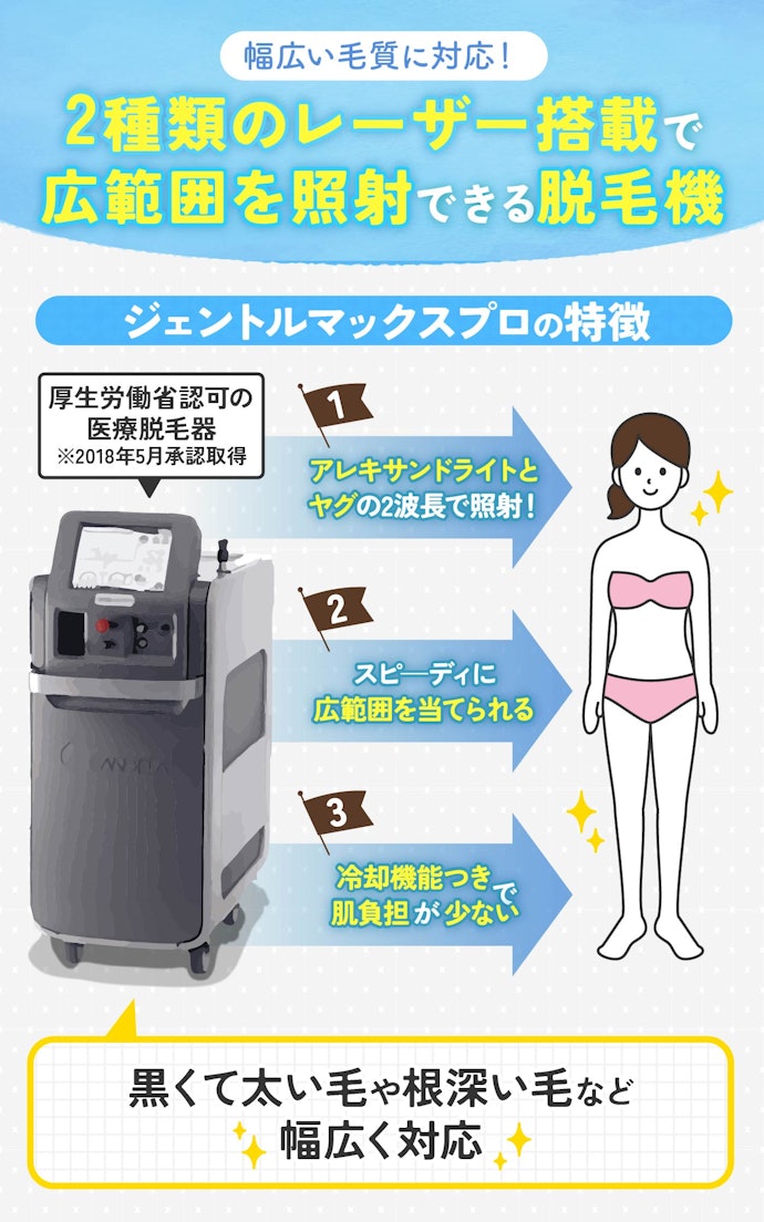 ジェントルマックスプロとは?どんな毛質に効果があるの?