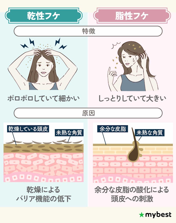 フケの原因は頭皮の乾燥?シャンプーで治る?