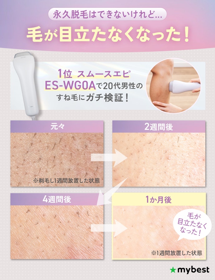 家庭用脱毛器はぶっちゃけ効果ない?永久脱毛できる?