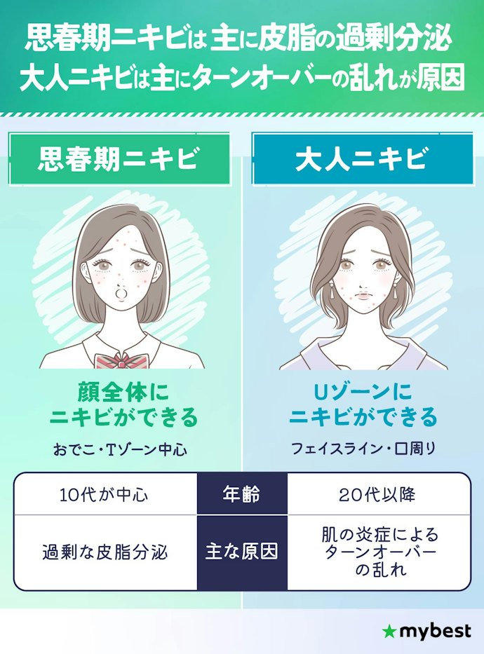 思春期ニキビと大人ニキビの違いと原因ってなに?