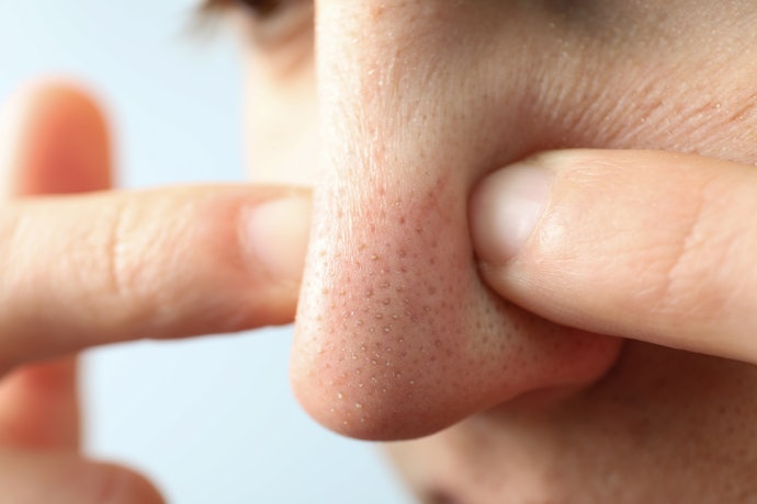 毛穴汚れの原因とは?男性は毛穴が詰まりやすい?