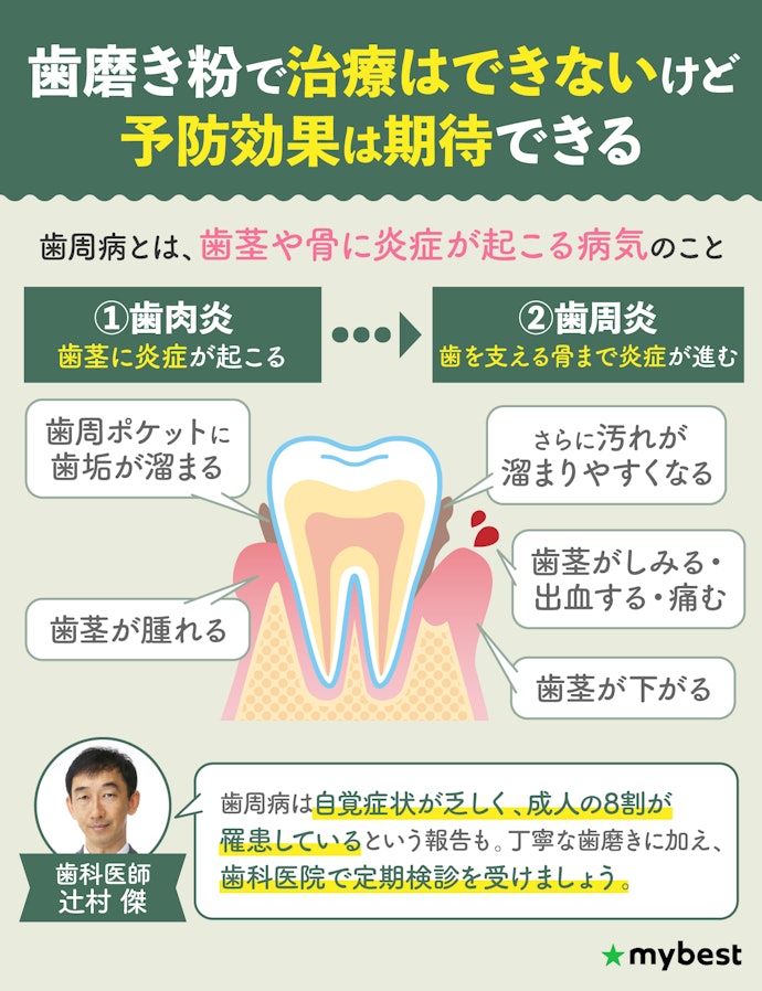 歯周病とは?歯磨きで予防・治療はできるの?