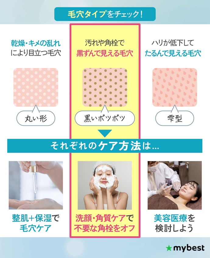 毛穴ってなぜ詰まるの?いちご鼻になるのはなぜ?