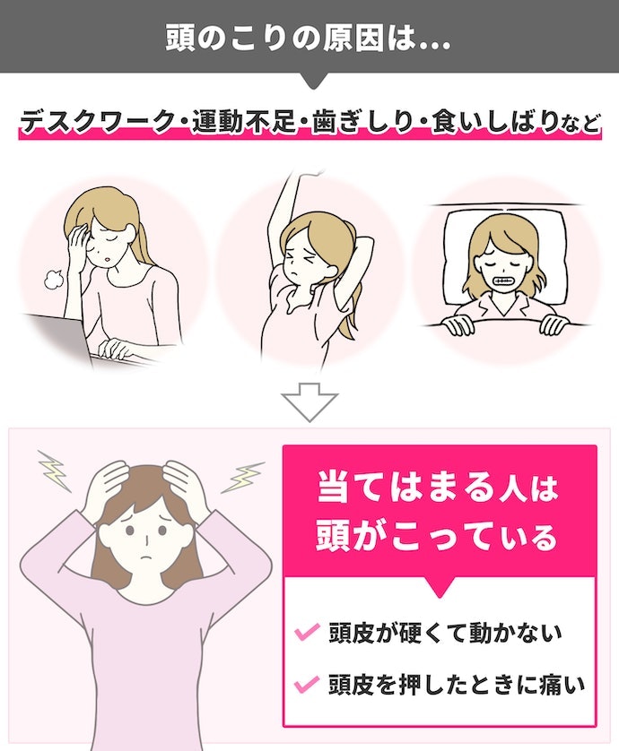 頭のコリの原因とは?セルフチェックの仕方は?