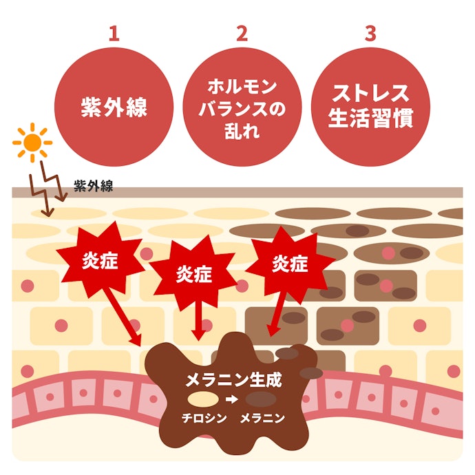 シミができる原因は何?