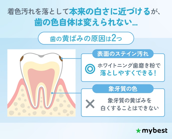 ホワイトニング歯磨き粉で歯は白くなるの?