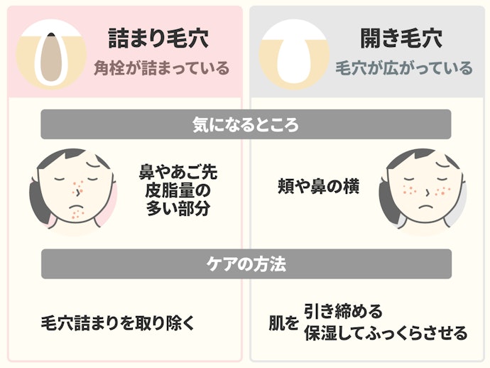 あなたの毛穴は何毛穴?毛穴の種類を確認して適切なお手入れを!