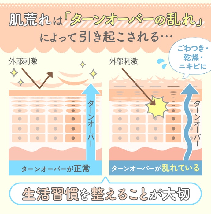 肌荒れはどうして起こるの?考えられる原因は?