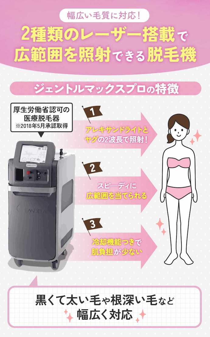 ジェントルマックスプロとは?どんな毛質に効果がある?