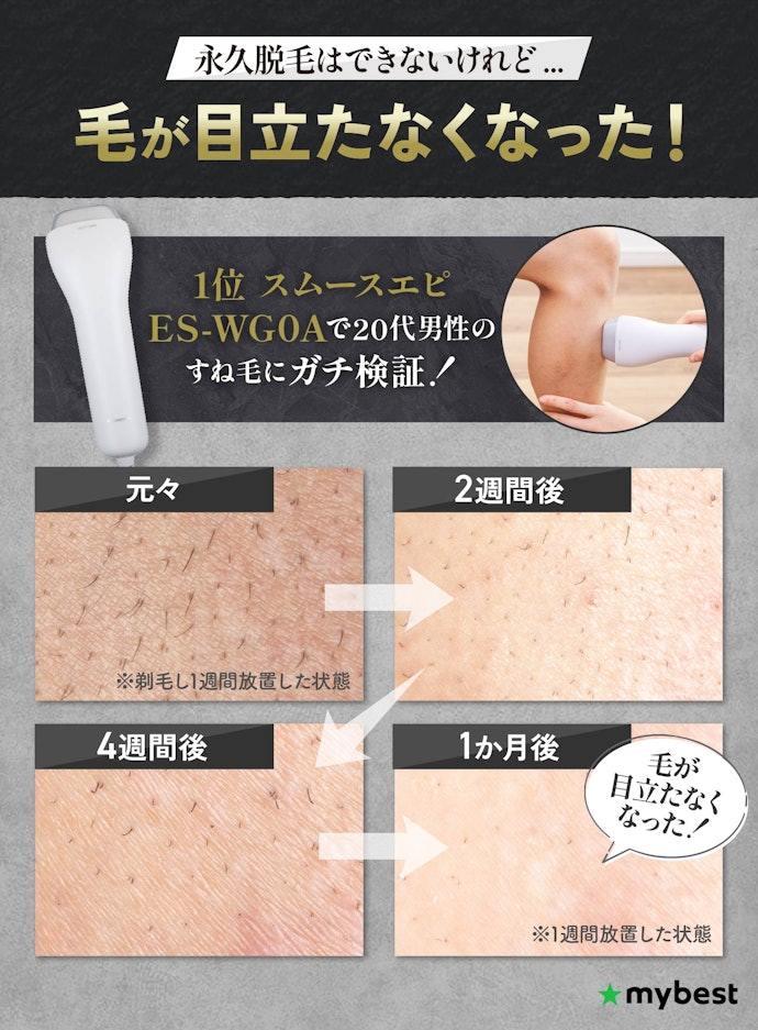 メンズ脱毛器はヒゲやすね毛に効果ない?永久脱毛はできる?