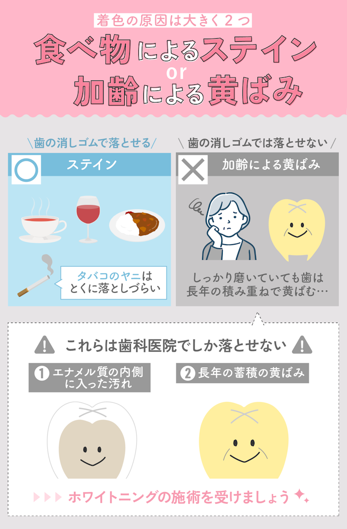 歯の着色汚れの原因は?歯の消しゴムで落とせる?