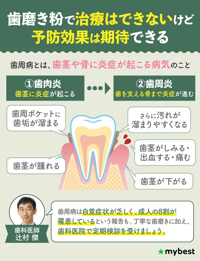 歯周病とは?歯磨きで予防・治療はできるの?