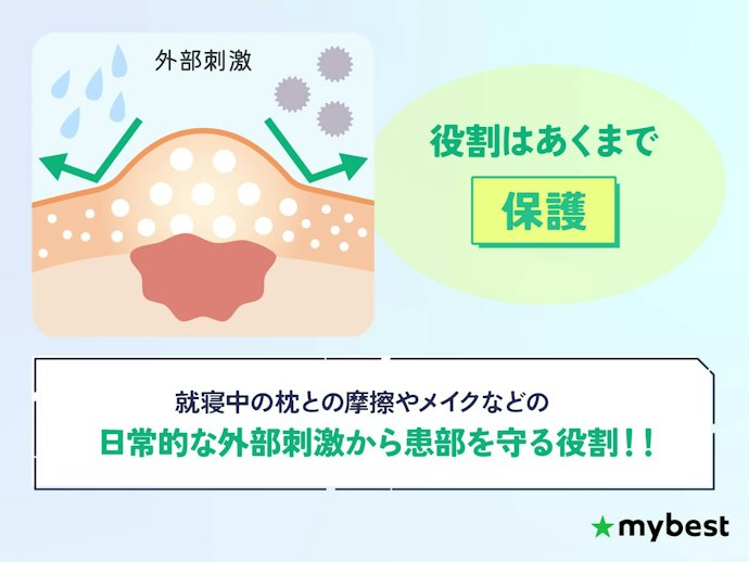 ニキビパッチを使うメリットとは?