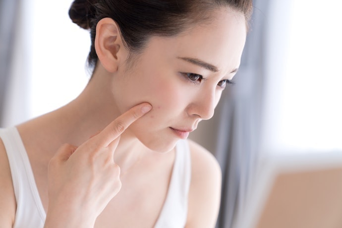 自由診療のニキビ治療にリスク・副作用はある?