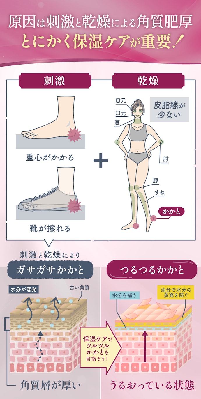 ガサガサかかとの原因は?正しいケアを教えて!