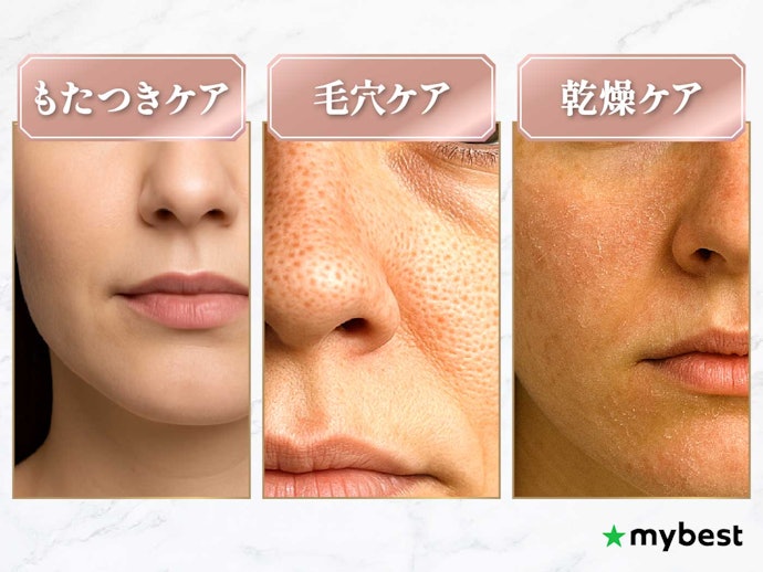 美顔器は何に効果があるの?