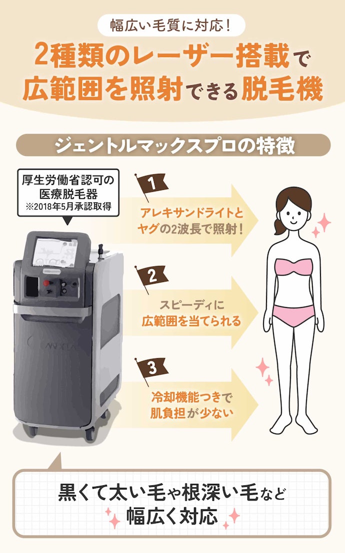 ジェントルマックスプロとは?どんな毛質に効果的?