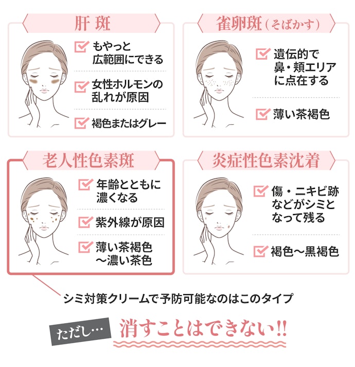シミ対策クリームの効果とは?できてしまったシミに効くの?
