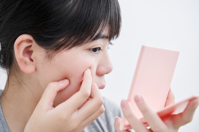 ニキビの市販薬と処方薬の違いは?