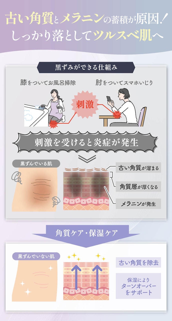 肘や膝の黒ずみの原因は?効果的なケア方法はある?