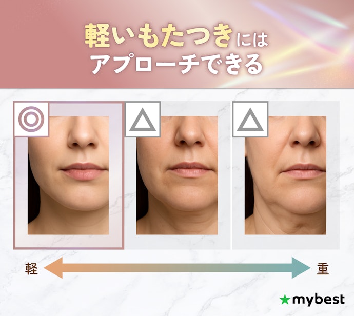 リフトアップ美顔器は、どの程度のもたつきになら効果が見込める?