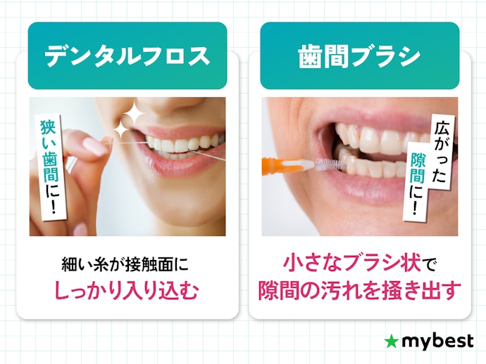 デンタルフロスとは?歯間ブラシとどう違う?